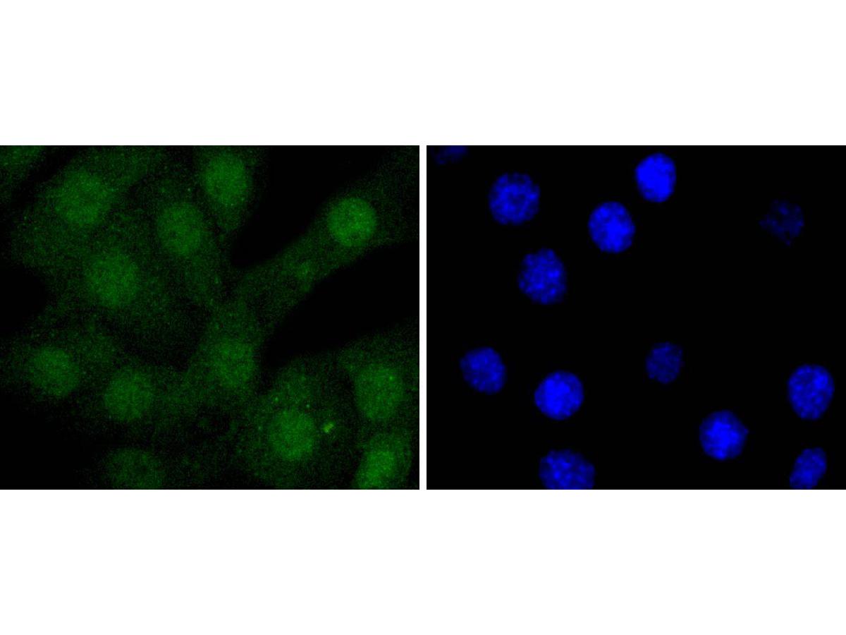 ICC staining of STAT 5A+B in NIH/3T3 cells (green). Formalin fixed cells were permeabilized with 0.1% Triton X-100 in TBS for 10 minutes at room temperature and blocked with 1% Blocker BSA for 15 minutes at room temperature. Cells were probed with the primary antibody (ET1701-45, 1/50) for 1 hour at room temperature, washed with PBS. Alexa Fluor®488 Goat anti-Rabbit IgG was used as the secondary antibody at 1/1,000 dilution. The nuclear counter stain is DAPI (blue).