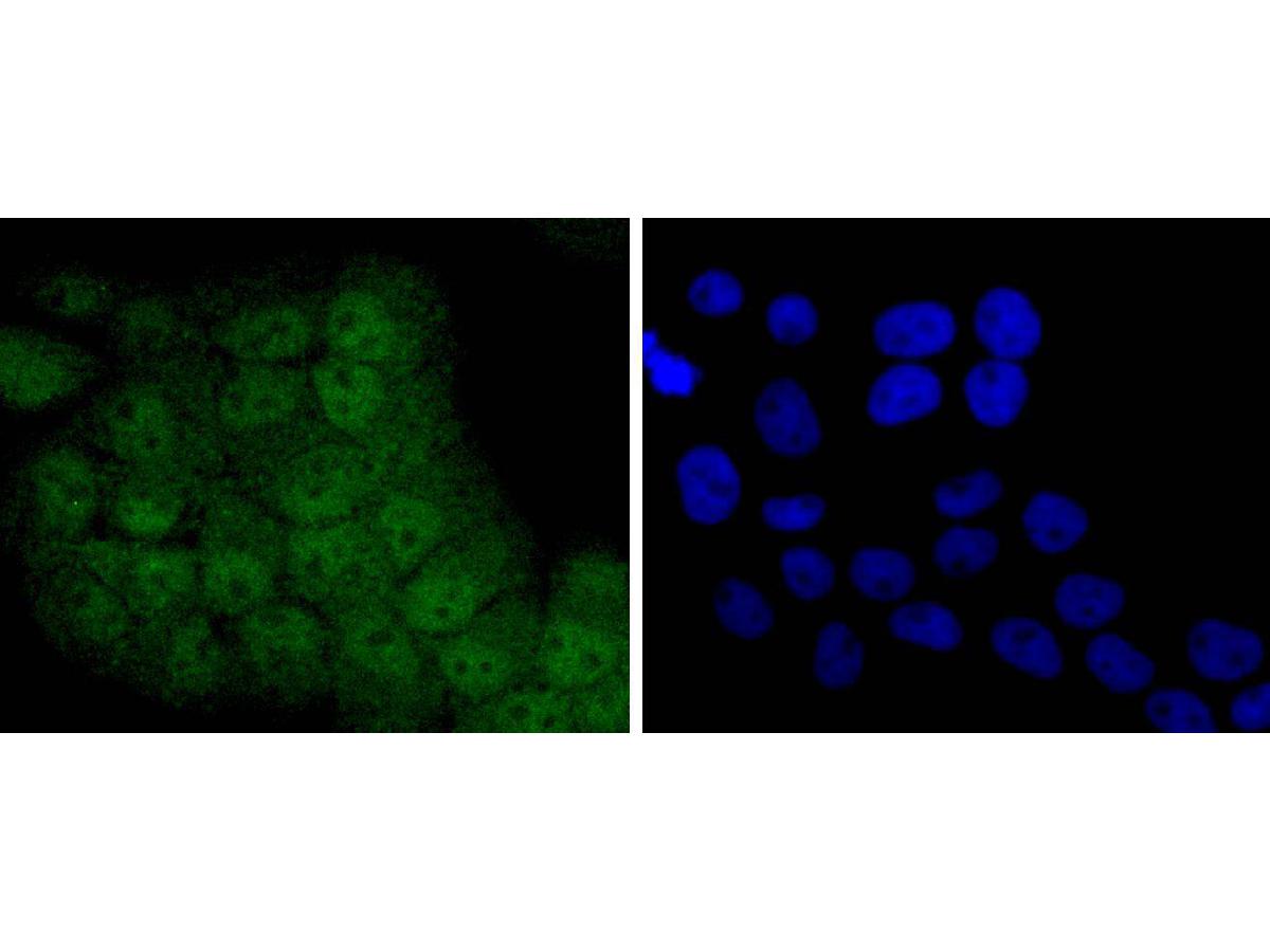 ICC staining of STAT 5A+B in RH-35 cells (green). Formalin fixed cells were permeabilized with 0.1% Triton X-100 in TBS for 10 minutes at room temperature and blocked with 1% Blocker BSA for 15 minutes at room temperature. Cells were probed with the primary antibody (ET1701-45, 1/50) for 1 hour at room temperature, washed with PBS. Alexa Fluor®488 Goat anti-Rabbit IgG was used as the secondary antibody at 1/1,000 dilution. The nuclear counter stain is DAPI (blue).