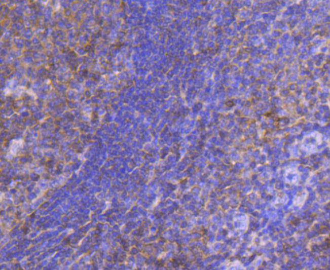 Immunohistochemical analysis of paraffin-embedded human tonsil tissue using anti-STAT 5A+B antibody. The section was pre-treated using heat mediated antigen retrieval with Tris-EDTA buffer (pH 8.0-8.4) for 20 minutes.The tissues were blocked in 5% BSA for 30 minutes at room temperature, washed with ddH2O and PBS, and then probed with the primary antibody (ET1701-45, 1/50) for 30 minutes at room temperature. The detection was performed using an HRP conjugated compact polymer system. DAB was used as the chromogen. Tissues were counterstained with hematoxylin and mounted with DPX.
