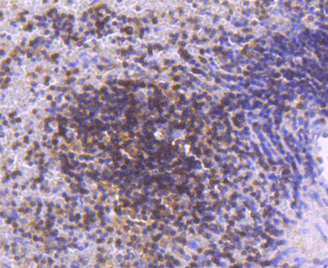 Immunohistochemical analysis of paraffin-embedded human spleen tissue using anti-STAT 5A+B antibody. The section was pre-treated using heat mediated antigen retrieval with Tris-EDTA buffer (pH 8.0-8.4) for 20 minutes.The tissues were blocked in 5% BSA for 30 minutes at room temperature, washed with ddH2O and PBS, and then probed with the primary antibody (ET1701-45, 1/50) for 30 minutes at room temperature. The detection was performed using an HRP conjugated compact polymer system. DAB was used as the chromogen. Tissues were counterstained with hematoxylin and mounted with DPX.