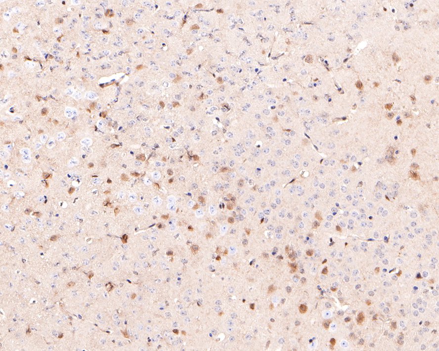 Immunohistochemical analysis of paraffin-embedded mouse brain tissue with Rabbit anti-STAT 5A+B antibody (ET1701-45) at 1/400 dilution.<br />
<br />
The section was pre-treated using heat mediated antigen retrieval with sodium citrate buffer (pH 6.0) for 2 minutes. The tissues were blocked in 1% BSA for 20 minutes at room temperature, washed with ddH2O and PBS, and then probed with the primary antibody (ET1701-45) at 1/400 dilution for 1 hour at room temperature. The detection was performed using an HRP conjugated compact polymer system. DAB was used as the chromogen. Tissues were counterstained with hematoxylin and mounted with DPX.