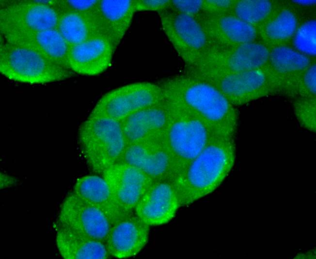 ICC staining of Phospho-PTEN(S380) in Hela cells (green). Formalin fixed cells were permeabilized with 0.1% Triton X-100 in TBS for 10 minutes at room temperature and blocked with 1% Blocker BSA for 15 minutes at room temperature. Cells were probed with the primary antibody (ET1701-46, 1/100) for 1 hour at room temperature, washed with PBS. Alexa Fluor®488 Goat anti-Rabbit IgG was used as the secondary antibody at 1/1,000 dilution. The nuclear counter stain is DAPI (blue).