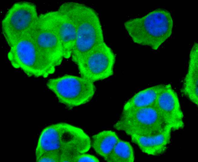 ICC staining of Phospho-PTEN(S380) in MCF-7 cells (green). Formalin fixed cells were permeabilized with 0.1% Triton X-100 in TBS for 10 minutes at room temperature and blocked with 1% Blocker BSA for 15 minutes at room temperature. Cells were probed with the primary antibody (ET1701-46, 1/100) for 1 hour at room temperature, washed with PBS. Alexa Fluor®488 Goat anti-Rabbit IgG was used as the secondary antibody at 1/1,000 dilution. The nuclear counter stain is DAPI (blue).