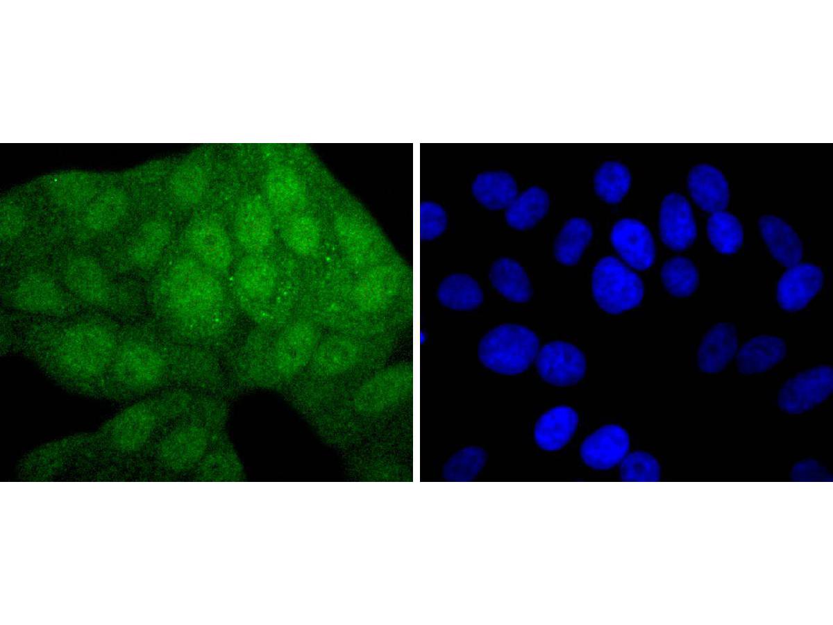 ICC staining of MEK3+MEK6 in HepG2 cells (green). Formalin fixed cells were permeabilized with 0.1% Triton X-100 in TBS for 10 minutes at room temperature and blocked with 1% Blocker BSA for 15 minutes at room temperature. Cells were probed with the primary antibody (ET1701-48, 1/50) for 1 hour at room temperature, washed with PBS. Alexa Fluor®488 Goat anti-Rabbit IgG was used as the secondary antibody at 1/1,000 dilution. The nuclear counter stain is DAPI (blue).