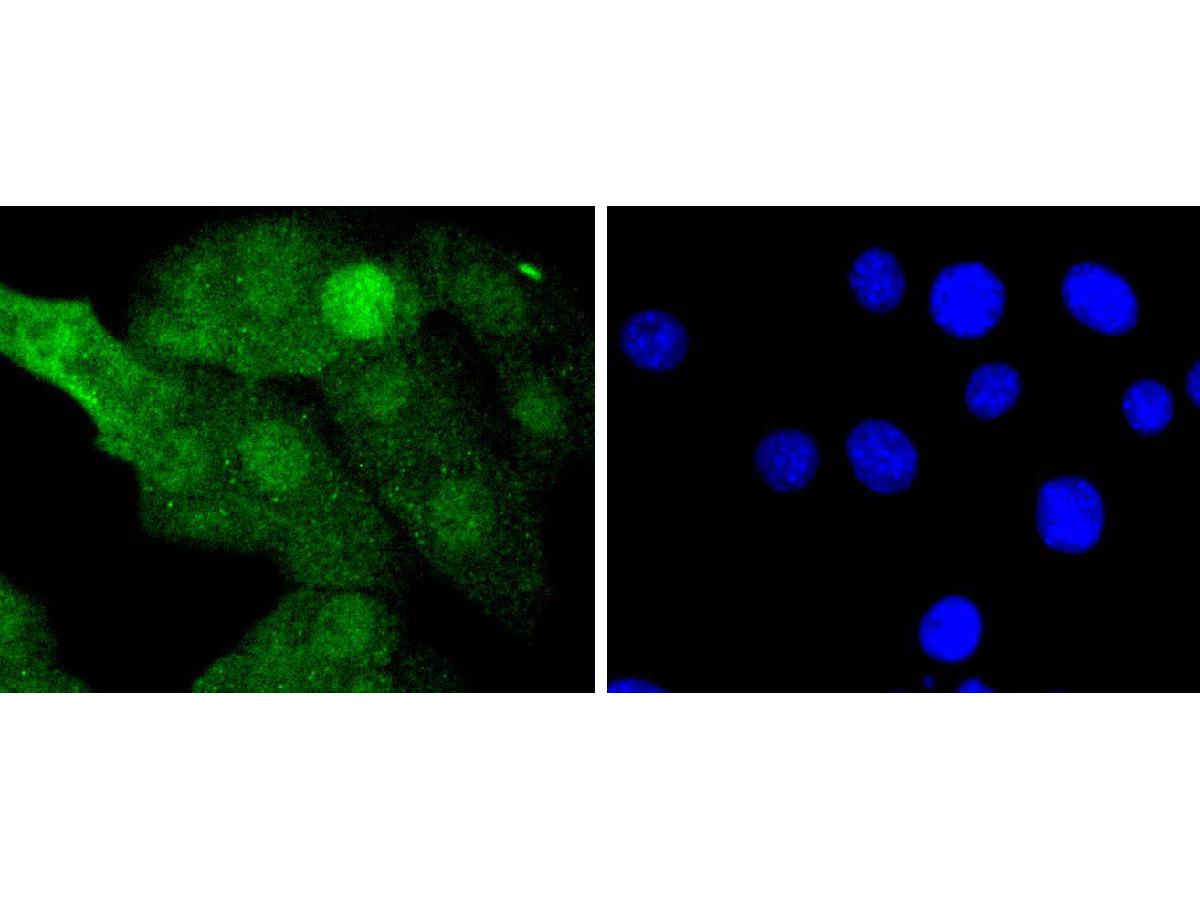 ICC staining of MEK3+MEK6 in NIH/3T3 cells (green). Formalin fixed cells were permeabilized with 0.1% Triton X-100 in TBS for 10 minutes at room temperature and blocked with 1% Blocker BSA for 15 minutes at room temperature. Cells were probed with the primary antibody (ET1701-48, 1/50) for 1 hour at room temperature, washed with PBS. Alexa Fluor®488 Goat anti-Rabbit IgG was used as the secondary antibody at 1/1,000 dilution. The nuclear counter stain is DAPI (blue).