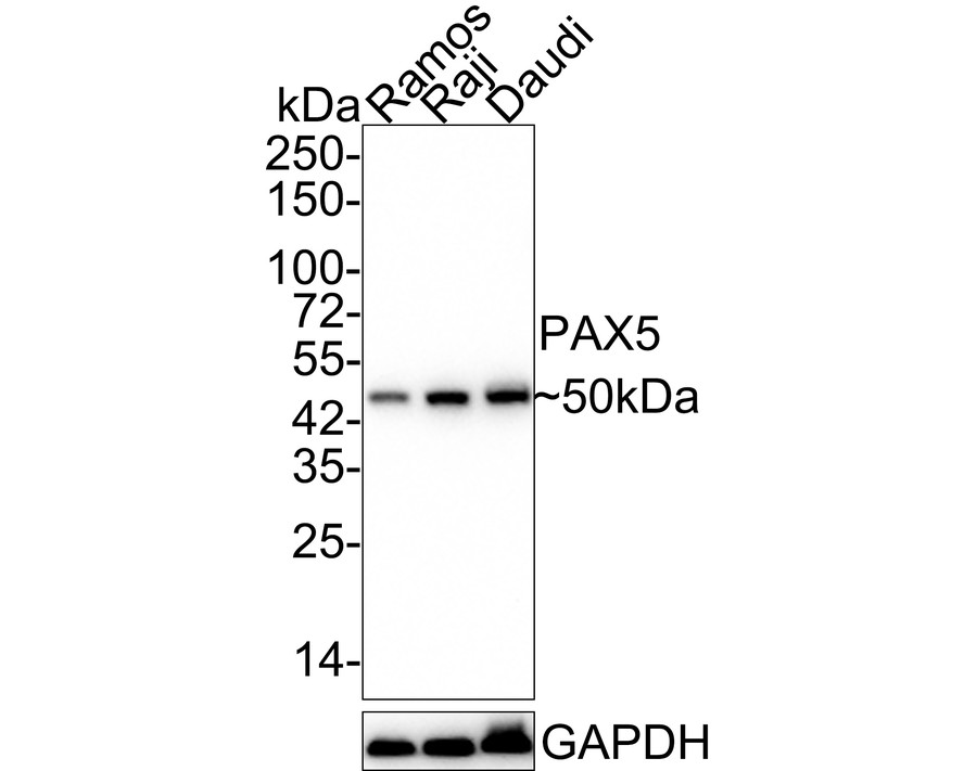Western blot analysis of PAX5 on Daudi cell lysates. Proteins were transferred to a PVDF membrane and blocked with 5% BSA in PBS for 1 hour at room temperature. The primary antibody (ET1701-49, 1/500) was used in 5% BSA at room temperature for 2 hours. Goat Anti-Rabbit IgG - HRP Secondary Antibody (HA1001) at 1:200,000 dilution was used for 1 hour at room temperature.