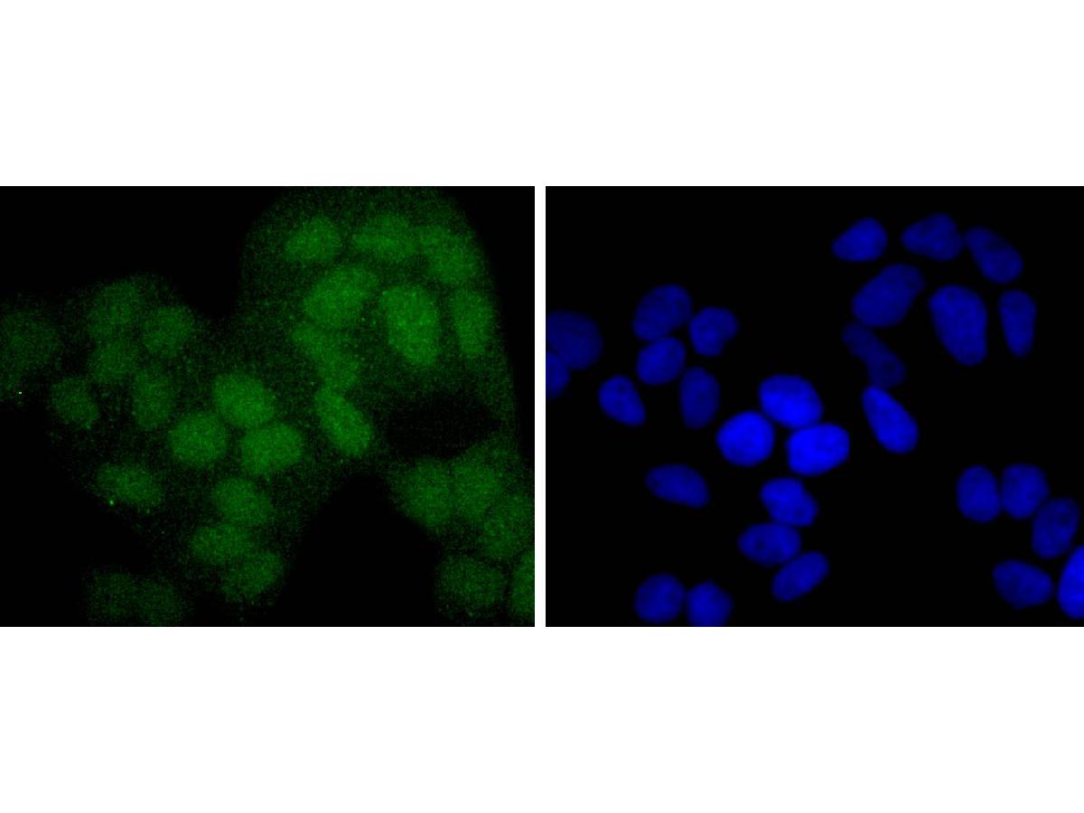 ICC staining of PAX5 in MCF-7 cells (green). Formalin fixed cells were permeabilized with 0.1% Triton X-100 in TBS for 10 minutes at room temperature and blocked with 10% negative goat serum for 15 minutes at room temperature. Cells were probed with the primary antibody (ET1701-49, 1/50) for 1 hour at room temperature, washed with PBS. Alexa Fluor®488 conjugate-Goat anti-Rabbit IgG was used as the secondary antibody at 1/1,000 dilution. The nuclear counter stain is DAPI (blue).