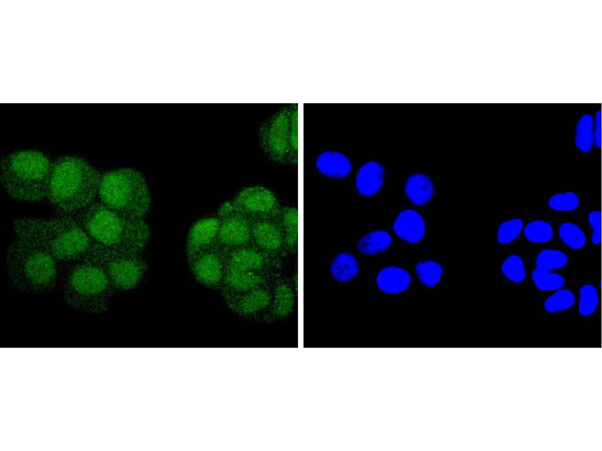 ICC staining of PAX5 in HepG2 cells (green). Formalin fixed cells were permeabilized with 0.1% Triton X-100 in TBS for 10 minutes at room temperature and blocked with 10% negative goat serum for 15 minutes at room temperature. Cells were probed with the primary antibody (ET1701-49, 1/50) for 1 hour at room temperature, washed with PBS. Alexa Fluor®488 conjugate-Goat anti-Rabbit IgG was used as the secondary antibody at 1/1,000 dilution. The nuclear counter stain is DAPI (blue).