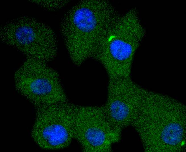 ICC staining of Phospho-SHIP(Y1020) in A549 cells (green). Formalin fixed cells were permeabilized with 0.1% Triton X-100 in TBS for 10 minutes at room temperature and blocked with 1% Blocker BSA for 15 minutes at room temperature. Cells were probed with the primary antibody (ET1701-5, 1/50) for 1 hour at room temperature, washed with PBS. Alexa Fluor®488 Goat anti-Rabbit IgG was used as the secondary antibody at 1/1,000 dilution. The nuclear counter stain is DAPI (blue).