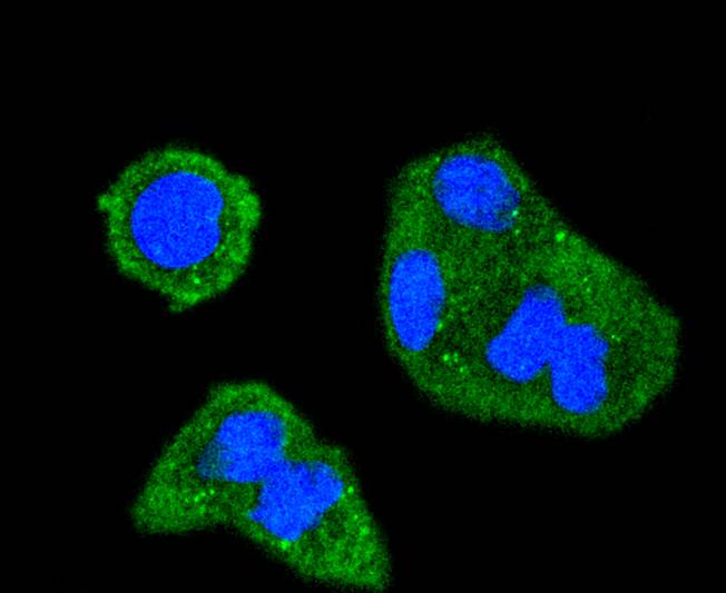 ICC staining of Phospho-SHIP(Y1020) in Hela cells (green). Formalin fixed cells were permeabilized with 0.1% Triton X-100 in TBS for 10 minutes at room temperature and blocked with 1% Blocker BSA for 15 minutes at room temperature. Cells were probed with the primary antibody (ET1701-5, 1/50) for 1 hour at room temperature, washed with PBS. Alexa Fluor®488 Goat anti-Rabbit IgG was used as the secondary antibody at 1/1,000 dilution. The nuclear counter stain is DAPI (blue).
