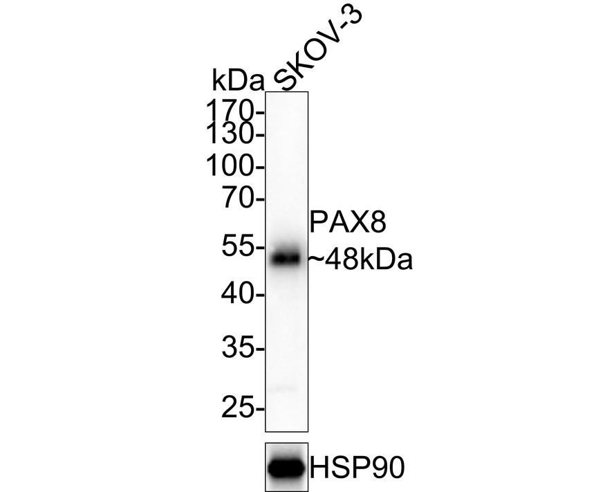 Western blot analysis of PAX8 on SKOV-3 cell lysates with Rabbit anti-PAX8 antibody (ET1701-50) at 1/1,000 dilution.<br />
<br />
Lysates/proteins at 10 µg/Lane.<br />
<br />
Predicted band size: 48 kDa<br />
Observed band size: 48 kDa<br />
<br />
Exposure time: 20 seconds;<br />
<br />
10% SDS-PAGE gel.<br />
<br />
Proteins were transferred to a PVDF membrane and blocked with 5% NFDM/TBST for 1 hour at room temperature. The primary antibody (ET1701-50) at 1/1,000 dilution was used in 5% NFDM/TBST at room temperature for 2 hours. Goat Anti-Rabbit IgG - HRP Secondary Antibody (HA1001) at 1:100,000 dilution was used for 1 hour at room temperature.