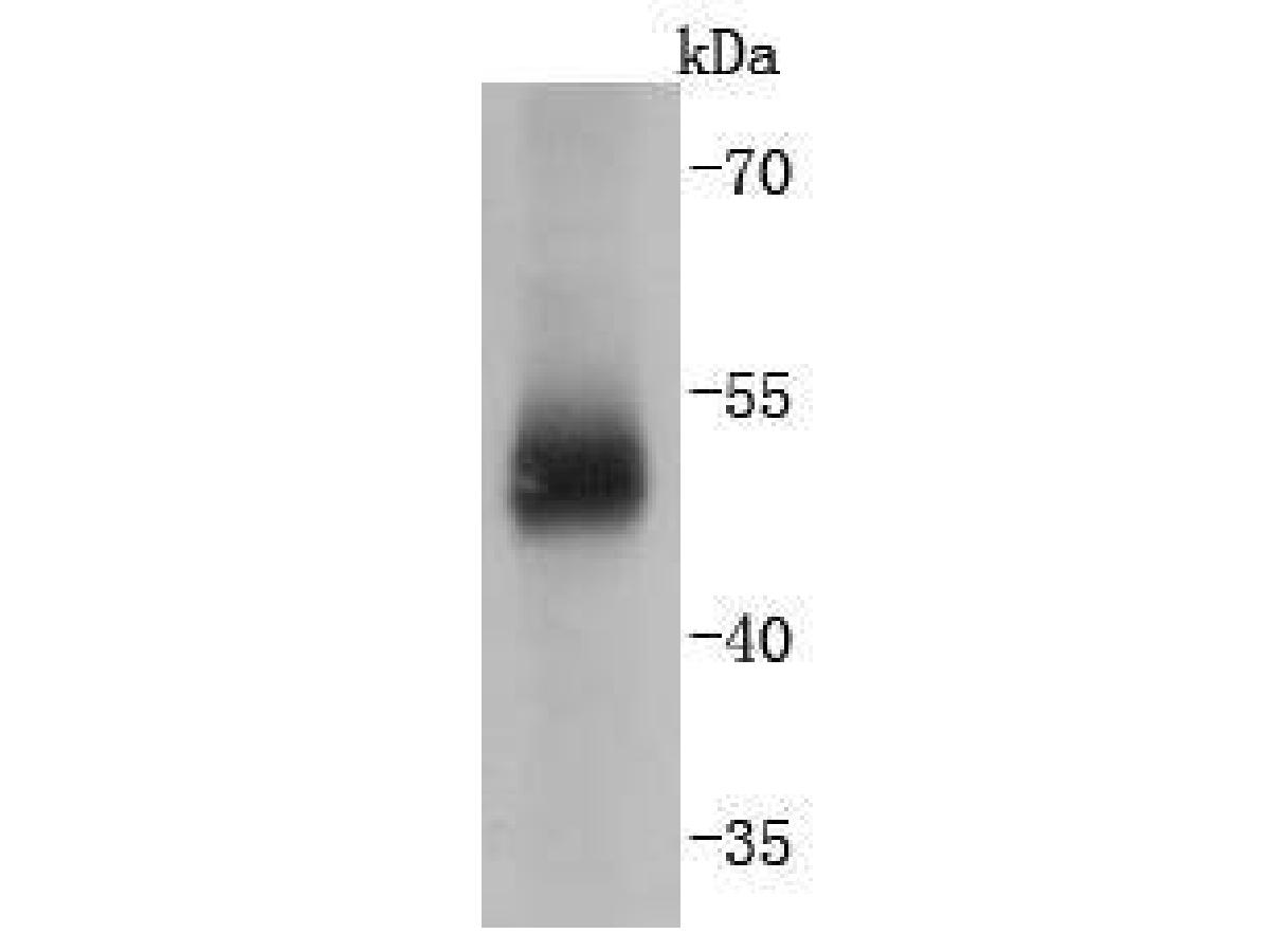 Western blot analysis of Carbonic anhydrase 9 on human lung tissue lysates. Proteins were transferred to a PVDF membrane and blocked with 5% BSA in PBS for 1 hour at room temperature. The primary antibody (ET1701-51, 1/500) was used in 5% BSA at room temperature for 2 hours. Goat Anti-Rabbit IgG - HRP Secondary Antibody (HA1001) at 1:40,000 dilution was used for 1 hour at room temperature.