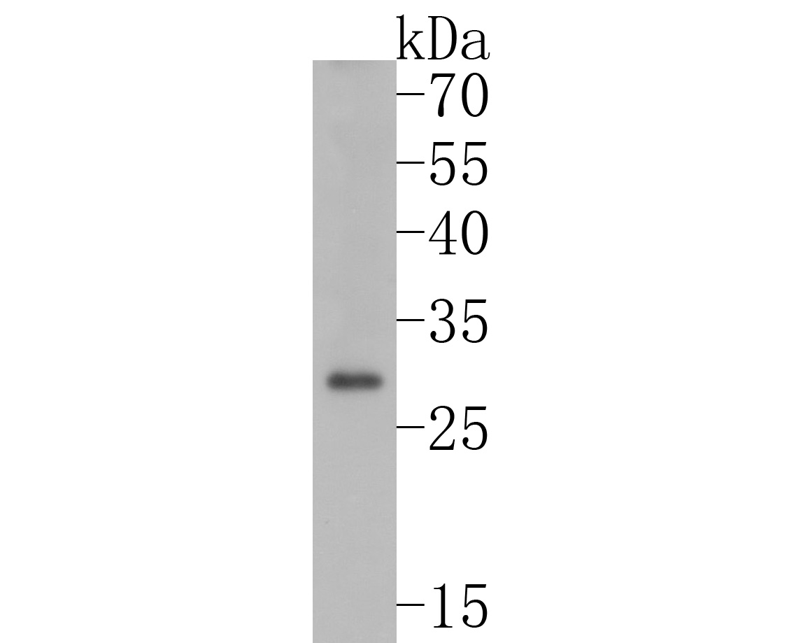 Western blot analysis of Caspase-14 on A431 cell lysates. Proteins were transferred to a PVDF membrane and blocked with 5% BSA in PBS for 1 hour at room temperature. The primary antibody (ET1701-52, 1/500) was used in 5% BSA at room temperature for 2 hours. Goat Anti-Rabbit IgG - HRP Secondary Antibody (HA1001) at 1:200,000 dilution was used for 1 hour at room temperature.