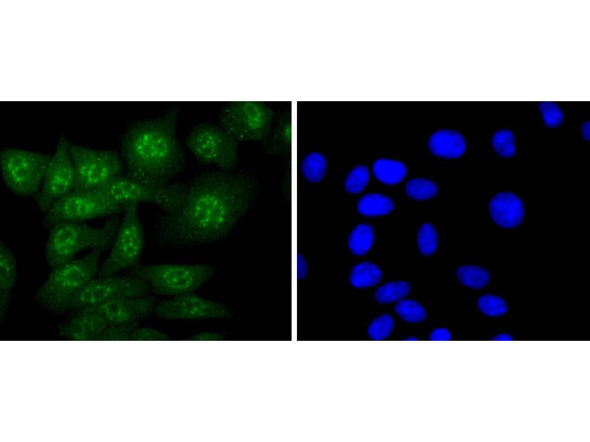 ICC staining of Caspase-14 in HepG2 cells (green). Formalin fixed cells were permeabilized with 0.1% Triton X-100 in TBS for 10 minutes at room temperature and blocked with 1% Blocker BSA for 15 minutes at room temperature. Cells were probed with the primary antibody (ET1701-52, 1/50) for 1 hour at room temperature, washed with PBS. Alexa Fluor®488 Goat anti-Rabbit IgG was used as the secondary antibody at 1/1,000 dilution. The nuclear counter stain is DAPI (blue).
