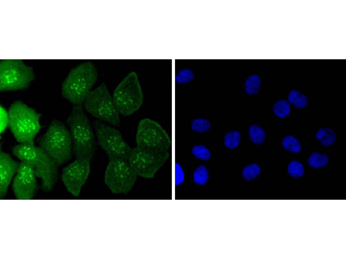 ICC staining of Caspase-14 in MCF-7 cells (green). Formalin fixed cells were permeabilized with 0.1% Triton X-100 in TBS for 10 minutes at room temperature and blocked with 1% Blocker BSA for 15 minutes at room temperature. Cells were probed with the primary antibody (ET1701-52, 1/50) for 1 hour at room temperature, washed with PBS. Alexa Fluor®488 Goat anti-Rabbit IgG was used as the secondary antibody at 1/1,000 dilution. The nuclear counter stain is DAPI (blue).