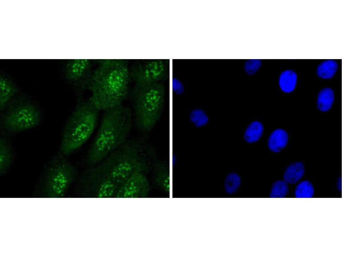 ICC staining of Caspase-14 in A431 cells (green). Formalin fixed cells were permeabilized with 0.1% Triton X-100 in TBS for 10 minutes at room temperature and blocked with 1% Blocker BSA for 15 minutes at room temperature. Cells were probed with the primary antibody (ET1701-52, 1/50) for 1 hour at room temperature, washed with PBS. Alexa Fluor®488 Goat anti-Rabbit IgG was used as the secondary antibody at 1/1,000 dilution. The nuclear counter stain is DAPI (blue).
