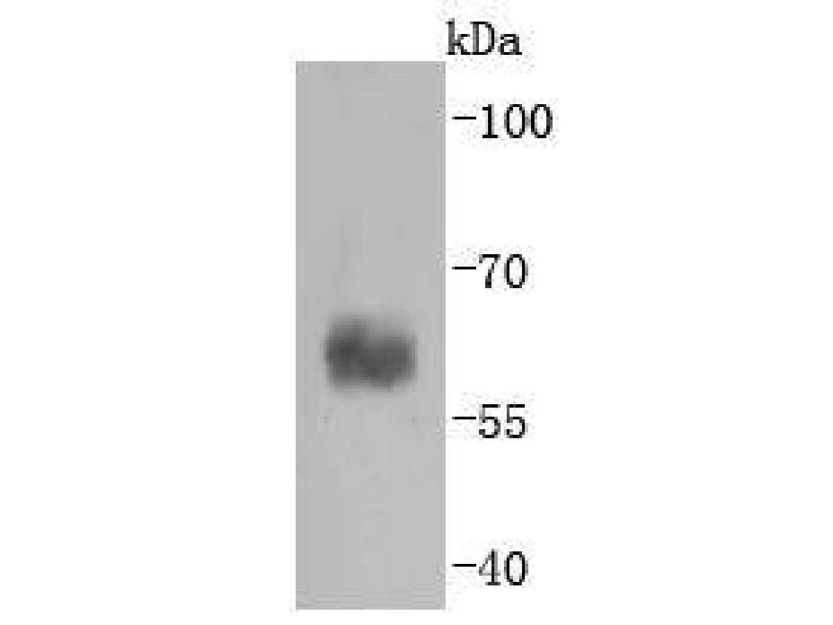 Western blot analysis of Caspase-10 on K562 cell lysates. Proteins were transferred to a PVDF membrane and blocked with 5% BSA in PBS for 1 hour at room temperature. The primary antibody (ET1701-53, 1/500) was used in 5% BSA at room temperature for 2 hours. Goat Anti-Rabbit IgG - HRP Secondary Antibody (HA1001) at 1:200,000 dilution was used for 1 hour at room temperature.