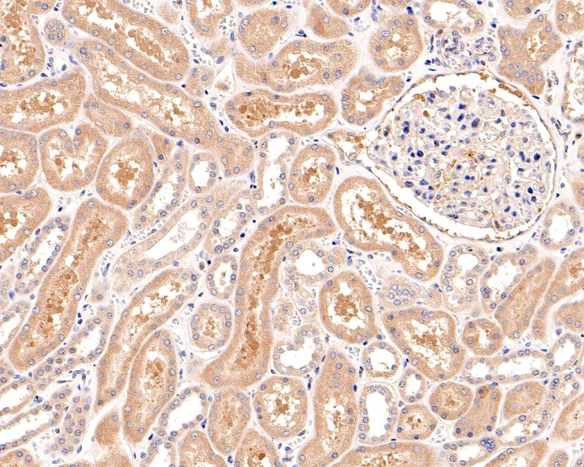 Immunohistochemical analysis of paraffin-embedded human kidney tissue with Rabbit anti-Caspase-10 antibody (ET1701-53) at 1/50 dilution.<br />
<br />
The section was pre-treated using heat mediated antigen retrieval with Tris-EDTA buffer (pH 9.0) for 20 minutes. The tissues were blocked in 1% BSA for 20 minutes at room temperature, washed with ddH2O and PBS, and then probed with the primary antibody (ET1701-53) at 1/50 dilution for 1 hour at room temperature. The detection was performed using an HRP conjugated compact polymer system. DAB was used as the chromogen. Tissues were counterstained with hematoxylin and mounted with DPX.