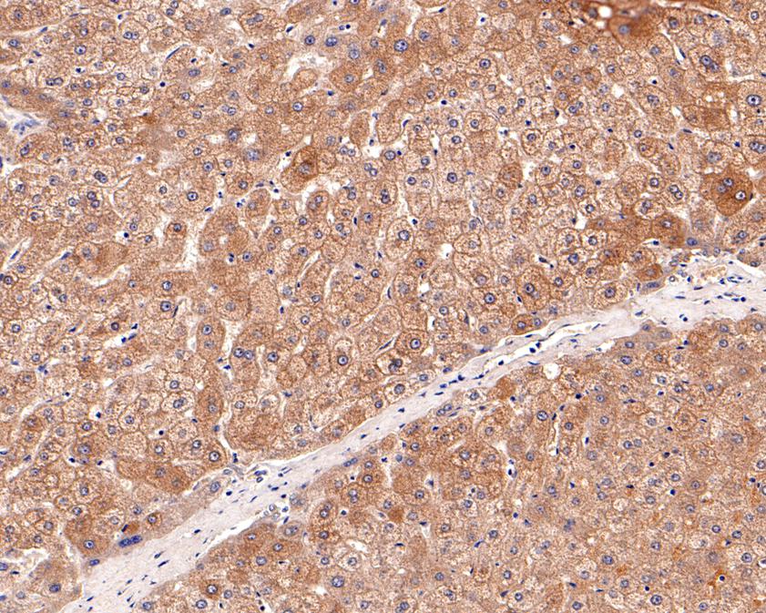 Immunohistochemical analysis of paraffin-embedded human liver tissue with Rabbit anti-Caspase-10 antibody (ET1701-53) at 1/50 dilution.<br />
<br />
The section was pre-treated using heat mediated antigen retrieval with Tris-EDTA buffer (pH 9.0) for 20 minutes. The tissues were blocked in 1% BSA for 20 minutes at room temperature, washed with ddH2O and PBS, and then probed with the primary antibody (ET1701-53) at 1/50 dilution for 1 hour at room temperature. The detection was performed using an HRP conjugated compact polymer system. DAB was used as the chromogen. Tissues were counterstained with hematoxylin and mounted with DPX.
