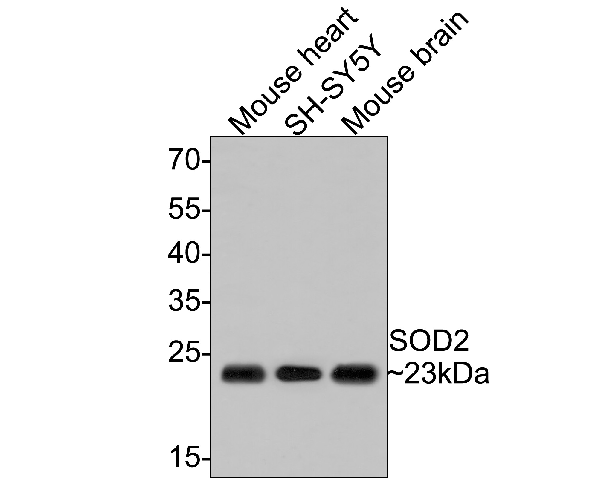 Western blot analysis of SOD2 on different lysates with Rabbit anti-SOD2 antibody (ET1701-54) at 1/500 dilution.<br />
<br />
Lane 1: Mouse heart tissue lysate<br />
Lane 2: SH-SY5Y cell lysate (10 µg/Lane)<br />
Lane 3: Mouse brain tissue lysate<br />
<br />
Lysates/proteins at 20 µg/Lane.<br />
<br />
Predicted band size: 25 kDa<br />
Observed band size: 23 kDa<br />
<br />
Exposure time: 1 minute;<br />
<br />
12% SDS-PAGE gel.<br />
<br />
Proteins were transferred to a PVDF membrane and blocked with 5% NFDM/TBST for 1 hour at room temperature. The primary antibody (ET1701-54) at 1/500 dilution was used in 5% NFDM/TBST at room temperature for 2 hours. Goat Anti-Rabbit IgG - HRP Secondary Antibody (HA1001) at 1:300,000 dilution was used for 1 hour at room temperature.