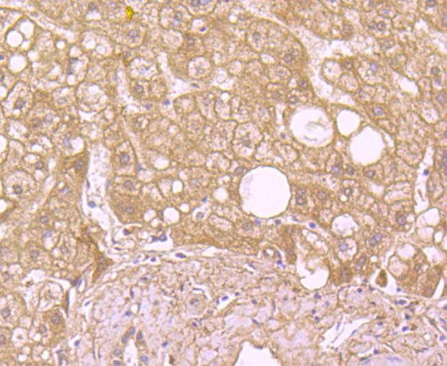 Immunohistochemical analysis of paraffin-embedded human liver tissue using anti-SOD2 antibody. The section was pre-treated using heat mediated antigen retrieval with Tris-EDTA buffer (pH 8.0-8.4) for 20 minutes.The tissues were blocked in 5% BSA for 30 minutes at room temperature, washed with ddH2O and PBS, and then probed with the primary antibody (ET1701-54, 1/50) for 30 minutes at room temperature. The detection was performed using an HRP conjugated compact polymer system. DAB was used as the chromogen. Tissues were counterstained with hematoxylin and mounted with DPX.