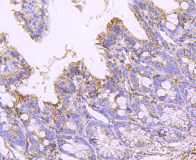 Immunohistochemical analysis of paraffin-embedded mouse colon tissue using anti-SOD2 antibody. The section was pre-treated using heat mediated antigen retrieval with Tris-EDTA buffer (pH 8.0-8.4) for 20 minutes.The tissues were blocked in 5% BSA for 30 minutes at room temperature, washed with ddH2O and PBS, and then probed with the primary antibody (ET1701-54, 1/50) for 30 minutes at room temperature. The detection was performed using an HRP conjugated compact polymer system. DAB was used as the chromogen. Tissues were counterstained with hematoxylin and mounted with DPX.