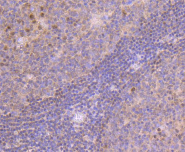 Immunohistochemical analysis of paraffin-embedded human tonsil tissue using anti-MGMT antibody. The section was pre-treated using heat mediated antigen retrieval with Tris-EDTA buffer (pH 9.0) for 20 minutes.The tissues were blocked in 1% BSA for 30 minutes at room temperature, washed with ddH2O and PBS, and then probed with the primary antibody (ET1701-55, 1/50) for 30 minutes at room temperature. The detection was performed using an HRP conjugated compact polymer system. DAB was used as the chromogen. Tissues were counterstained with hematoxylin and mounted with DPX.