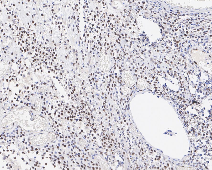 ICC staining of KMT6/EZH2 in HepG2 cells (green). Formalin fixed cells were permeabilized with 0.1% Triton X-100 in TBS for 10 minutes at room temperature and blocked with 10% negative goat serum for 15 minutes at room temperature. Cells were probed with the primary antibody (ET1701-56, 1/50) for 1 hour at room temperature, washed with PBS. Alexa Fluor®488 conjugate-Goat anti-Rabbit IgG was used as the secondary antibody at 1/1,000 dilution. The nuclear counter stain is DAPI (blue).