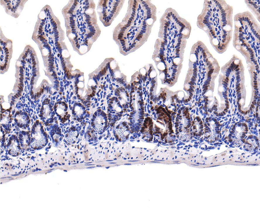 Immunohistochemical analysis of paraffin-embedded mouse colon tissue with Rabbit anti-KMT6/EZH2 antibody (ET1701-56) at 1/400 dilution.<br />
<br />
The section was pre-treated using heat mediated antigen retrieval with sodium citrate buffer (pH 6.0) for 2 minutes. The tissues were blocked in 1% BSA for 20 minutes at room temperature, washed with ddH2O and PBS, and then probed with the primary antibody (ET1701-56) at 1/400 dilution for 1 hour at room temperature. The detection was performed using an HRP conjugated compact polymer system. DAB was used as the chromogen. Tissues were counterstained with hematoxylin and mounted with DPX.