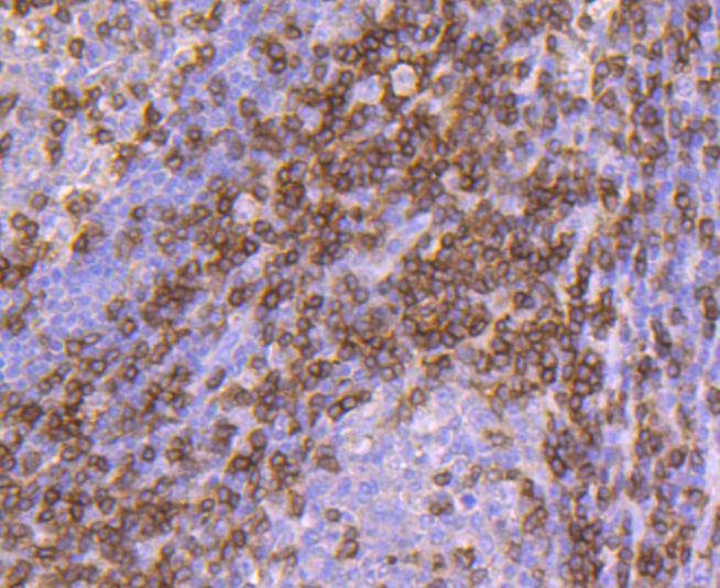 Immunohistochemical analysis of paraffin-embedded human tonsil tissue using anti-CD3D antibody. The section was pre-treated using heat mediated antigen retrieval with Tris-EDTA buffer (pH 8.0-8.4) for 20 minutes.The tissues were blocked in 5% BSA for 30 minutes at room temperature, washed with ddH2O and PBS, and then probed with the primary antibody (ET1701-57, 1/50) for 30 minutes at room temperature. The detection was performed using an HRP conjugated compact polymer system. DAB was used as the chromogen. Tissues were counterstained with hematoxylin and mounted with DPX.