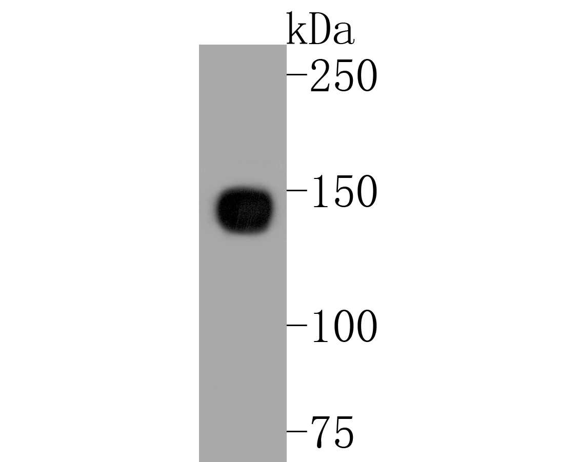 Western blot analysis of Integrin alpha 5 on NIH/3T3 cell lysates. Proteins were transferred to a PVDF membrane and blocked with 5% BSA in PBS for 1 hour at room temperature. The primary antibody (ET1701-58, 1/500) was used in 5% BSA at room temperature for 2 hours. Goat Anti-Rabbit IgG - HRP Secondary Antibody (HA1001) at 1:5,000 dilution was used for 1 hour at room temperature.