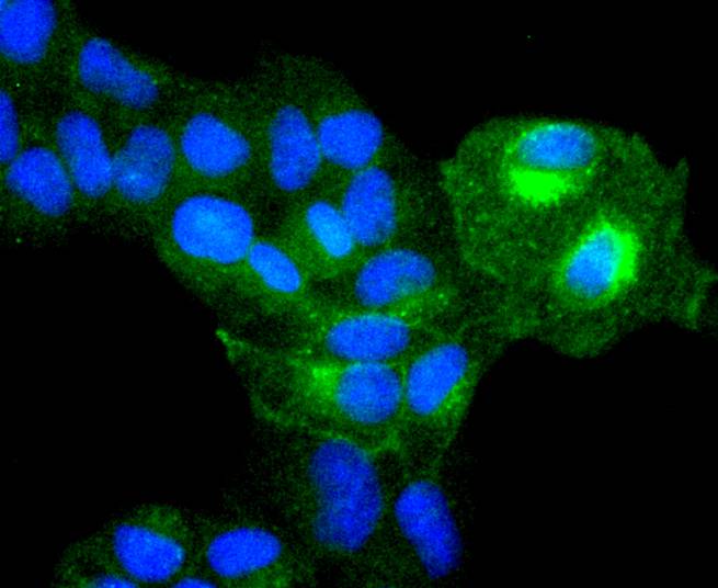 ICC staining of Integrin alpha 5 in Hela cells (green). Formalin fixed cells were permeabilized with 0.1% Triton X-100 in TBS for 10 minutes at room temperature and blocked with 1% Blocker BSA for 15 minutes at room temperature. Cells were probed with the primary antibody (ET1701-58, 1/50) for 1 hour at room temperature, washed with PBS. Alexa Fluor®488 Goat anti-Rabbit IgG was used as the secondary antibody at 1/1,000 dilution. The nuclear counter stain is DAPI (blue).