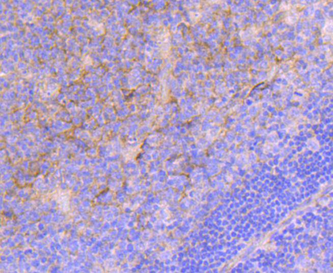 Immunohistochemical analysis of paraffin-embedded human tonsil tissue using anti-Integrin alpha 5 antibody. The section was pre-treated using heat mediated antigen retrieval with Tris-EDTA buffer (pH 8.0-8.4) for 20 minutes.The tissues were blocked in 5% BSA for 30 minutes at room temperature, washed with ddH2O and PBS, and then probed with the primary antibody (ET1701-58, 1/50) for 30 minutes at room temperature. The detection was performed using an HRP conjugated compact polymer system. DAB was used as the chromogen. Tissues were counterstained with hematoxylin and mounted with DPX.