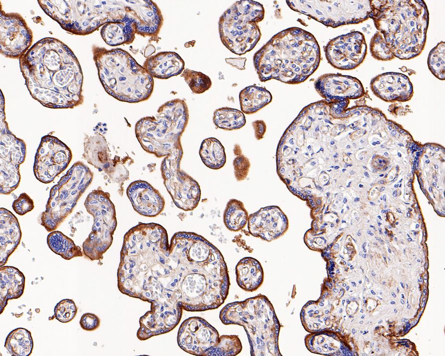 Immunohistochemical analysis of paraffin-embedded human uterus tissue using anti-Integrin alpha 5 antibody. The section was pre-treated using heat mediated antigen retrieval with Tris-EDTA buffer (pH 8.0-8.4) for 20 minutes.The tissues were blocked in 5% BSA for 30 minutes at room temperature, washed with ddH2O and PBS, and then probed with the primary antibody (ET1701-58, 1/50) for 30 minutes at room temperature. The detection was performed using an HRP conjugated compact polymer system. DAB was used as the chromogen. Tissues were counterstained with hematoxylin and mounted with DPX.