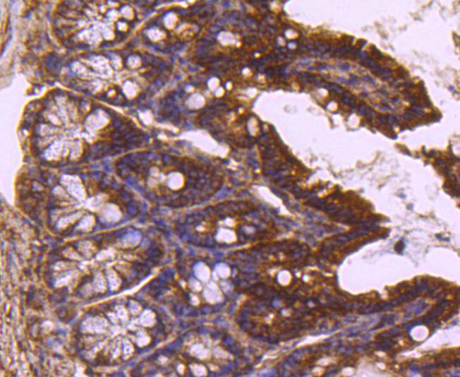 Immunohistochemical analysis of paraffin-embedded mouse kidney tissue using anti-TSG101 antibody. The section was pre-treated using heat mediated antigen retrieval with Tris-EDTA buffer (pH 8.0-8.4) for 20 minutes.The tissues were blocked in 5% BSA for 30 minutes at room temperature, washed with ddH2O and PBS, and then probed with the primary antibody (ET1701-59, 1/50) for 30 minutes at room temperature. The detection was performed using an HRP conjugated compact polymer system. DAB was used as the chromogen. Tissues were counterstained with hematoxylin and mounted with DPX.
