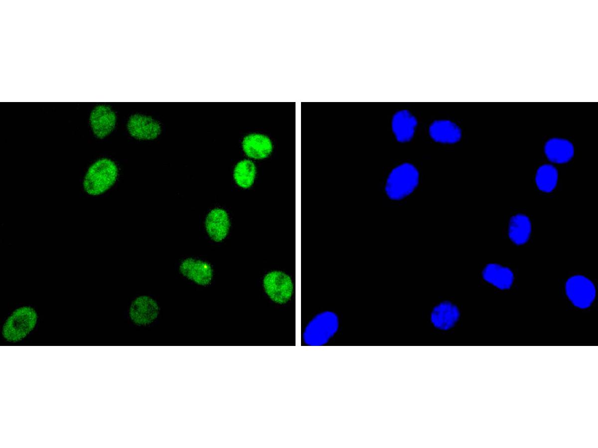 ICC staining of ARID1A in SH-SY5Y cells (green). Formalin fixed cells were permeabilized with 0.1% Triton X-100 in TBS for 10 minutes at room temperature and blocked with 10% negative goat serum for 15 minutes at room temperature. Cells were probed with the primary antibody (ET1701-60, 1/50) for 1 hour at room temperature, washed with PBS. Alexa Fluor®488 conjugate-Goat anti-Rabbit IgG was used as the secondary antibody at 1/1,000 dilution. The nuclear counter stain is DAPI (blue).