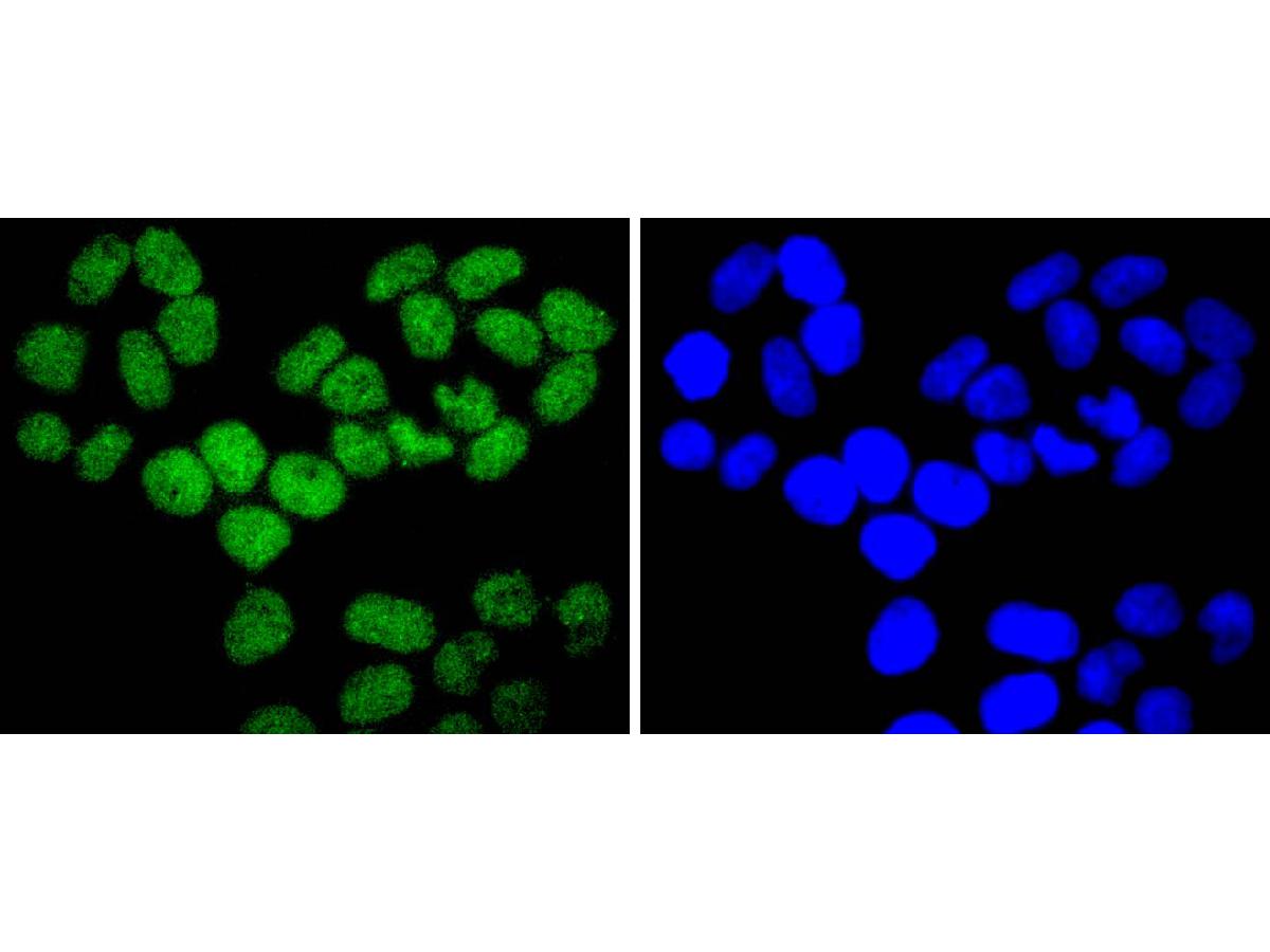 ICC staining of ARID1A in Hela cells (green). Formalin fixed cells were permeabilized with 0.1% Triton X-100 in TBS for 10 minutes at room temperature and blocked with 10% negative goat serum for 15 minutes at room temperature. Cells were probed with the primary antibody (ET1701-60, 1/50) for 1 hour at room temperature, washed with PBS. Alexa Fluor®488 conjugate-Goat anti-Rabbit IgG was used as the secondary antibody at 1/1,000 dilution. The nuclear counter stain is DAPI (blue).
