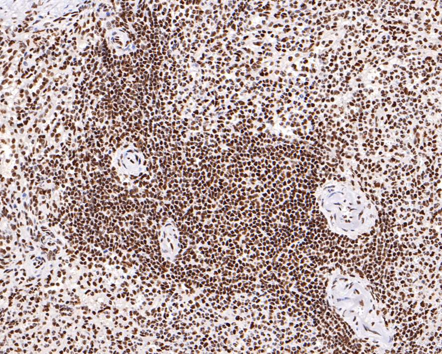 Immunohistochemical analysis of paraffin-embedded human spleen tissue using anti-ARID1A antibody. The section was pre-treated using heat mediated antigen retrieval with sodium citrate buffer (pH 6.0) for 20 minutes. The tissues were blocked in 1% BSA for 30 minutes at room temperature, washed with ddH2O and PBS, and then probed with the primary antibody (ET1701-60, 1/400)  for 30 minutes at room temperature. The detection was performed using an HRP conjugated compact polymer system. DAB was used as the chromogen. Tissues were counterstained with hematoxylin and mounted with DPX.