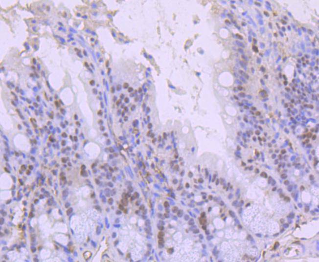 Immunohistochemical analysis of paraffin-embedded mouse colon tissue using anti-ARID1A antibody. The section was pre-treated using heat mediated antigen retrieval with Tris-EDTA buffer (pH 9.0) for 20 minutes.The tissues were blocked in 1% BSA for 30 minutes at room temperature, washed with ddH2O and PBS, and then probed with the primary antibody (ET1701-60, 1/50) for 30 minutes at room temperature. The detection was performed using an HRP conjugated compact polymer system. DAB was used as the chromogen. Tissues were counterstained with hematoxylin and mounted with DPX.