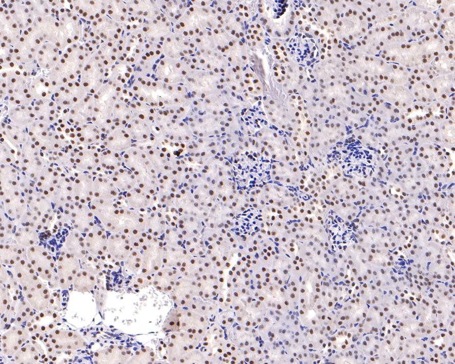 Immunohistochemical analysis of paraffin-embedded mouse kidney tissue using anti-ARID1A antibody. The section was pre-treated using heat mediated antigen retrieval with sodium citrate buffer (pH 6.0) for 20 minutes. The tissues were blocked in 1% BSA for 30 minutes at room temperature, washed with ddH2O and PBS, and then probed with the primary antibody (ET1701-60, 1/400)  for 30 minutes at room temperature. The detection was performed using an HRP conjugated compact polymer system. DAB was used as the chromogen. Tissues were counterstained with hematoxylin and mounted with DPX.