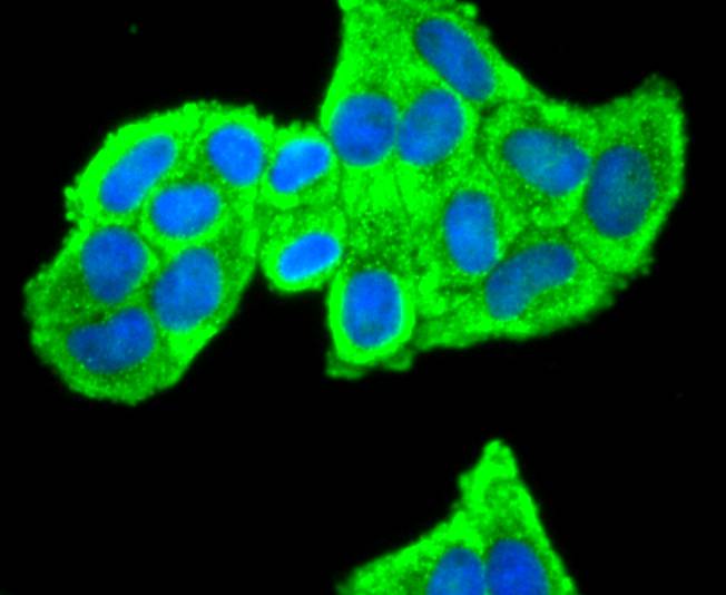 ICC staining of PRDX2 in Hela cells (green). Formalin fixed cells were permeabilized with 0.1% Triton X-100 in TBS for 10 minutes at room temperature and blocked with 10% negative goat serum for 15 minutes at room temperature. Cells were probed with the primary antibody (ET1701-61, 1/50) for 1 hour at room temperature, washed with PBS. Alexa Fluor®488 conjugate-Goat anti-Rabbit IgG was used as the secondary antibody at 1/1,000 dilution. The nuclear counter stain is DAPI (blue).