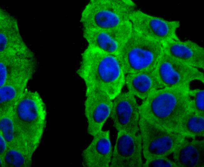 ICC staining of PRDX2 in RH-35 cells (green). Formalin fixed cells were permeabilized with 0.1% Triton X-100 in TBS for 10 minutes at room temperature and blocked with 10% negative goat serum for 15 minutes at room temperature. Cells were probed with the primary antibody (ET1701-61, 1/50) for 1 hour at room temperature, washed with PBS. Alexa Fluor®488 conjugate-Goat anti-Rabbit IgG was used as the secondary antibody at 1/1,000 dilution. The nuclear counter stain is DAPI (blue).