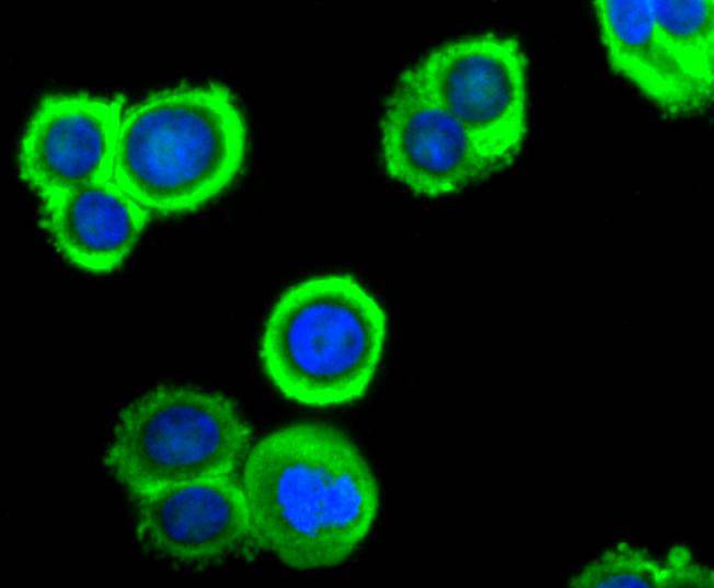 ICC staining of PRDX2 in SW480 cells (green). Formalin fixed cells were permeabilized with 0.1% Triton X-100 in TBS for 10 minutes at room temperature and blocked with 10% negative goat serum for 15 minutes at room temperature. Cells were probed with the primary antibody (ET1701-61, 1/50) for 1 hour at room temperature, washed with PBS. Alexa Fluor®488 conjugate-Goat anti-Rabbit IgG was used as the secondary antibody at 1/1,000 dilution. The nuclear counter stain is DAPI (blue).