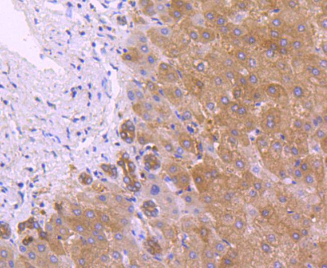 Immunohistochemical analysis of paraffin-embedded human liver tissue using anti-PRDX2 antibody. The section was pre-treated using heat mediated antigen retrieval with Tris-EDTA buffer (pH 9.0) for 20 minutes.The tissues were blocked in 1% BSA for 30 minutes at room temperature, washed with ddH2O and PBS, and then probed with the primary antibody (ET1701-61, 1/50) for 30 minutes at room temperature. The detection was performed using an HRP conjugated compact polymer system. DAB was used as the chromogen. Tissues were counterstained with hematoxylin and mounted with DPX.