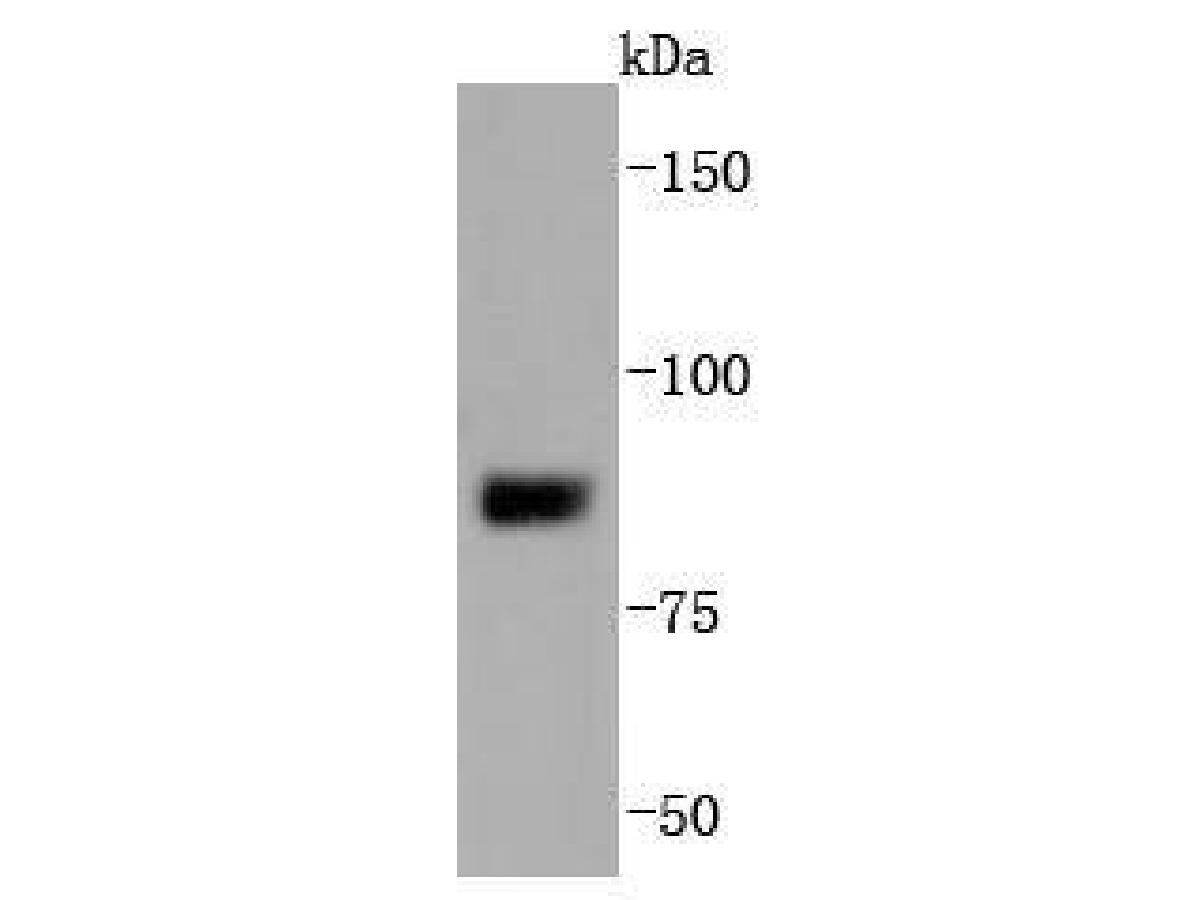 Western blot analysis of SUZ12 on MCF-7 cells lysates using anti-SUZ12 antibody at 1/1,000 dilution.