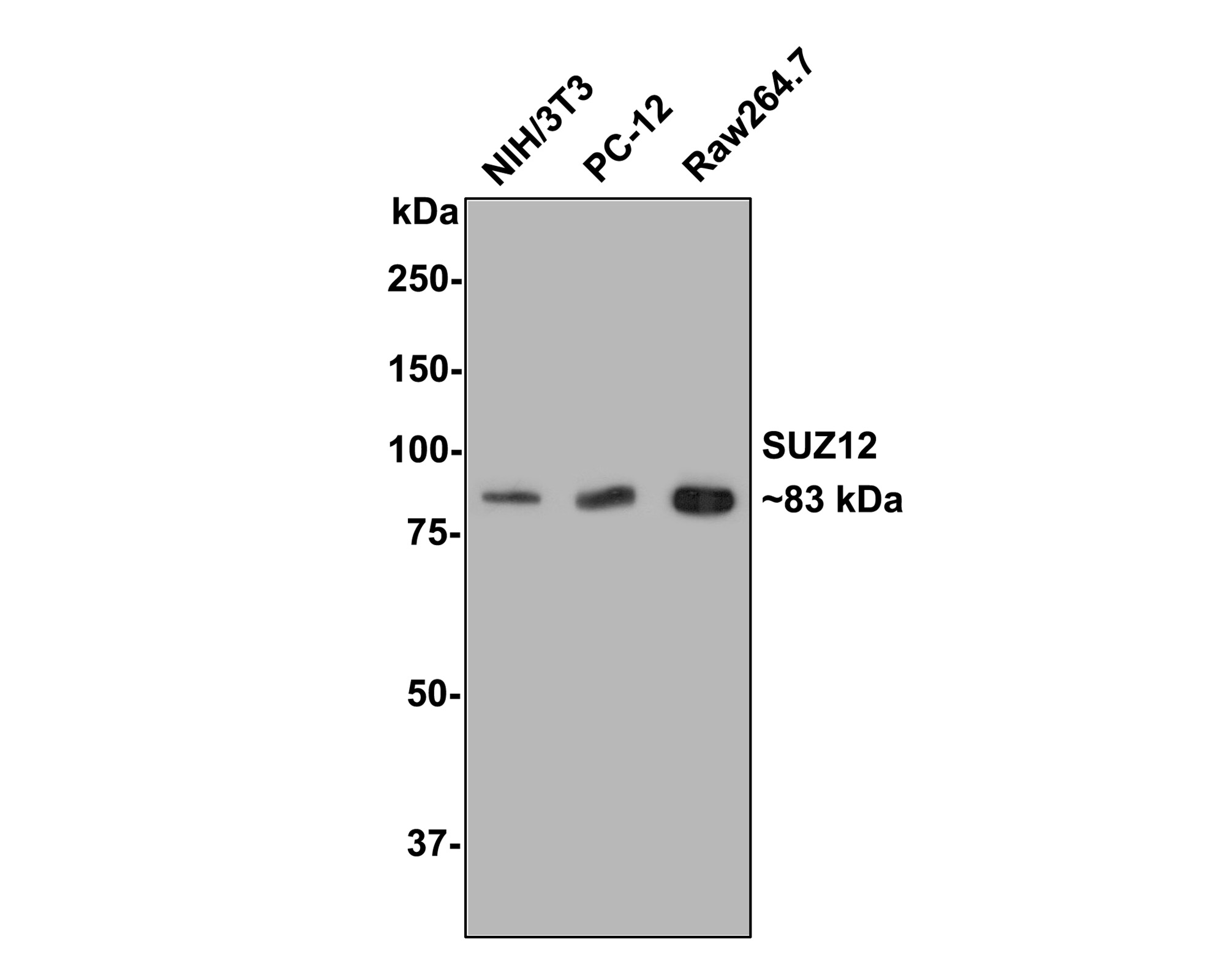 Western blot analysis of SUZ12 on different lysates with Rabbit anti-SUZ12 antibody (ET1701-62) at 1/500 dilution.<br />
<br />
Lane 1: NIH/3T3 cell lysate<br />
Lane 2: PC-12 cell lysate<br />
Lane 3: Raw264.7 cell lysate<br />
<br />
Lysates/proteins at 10 µg/Lane.<br />
<br />
Predicted band size: 83 kDa<br />
Observed band size: 83 kDa<br />
<br />
Exposure time: 2 minutes;<br />
<br />
8% SDS-PAGE gel.<br />
<br />
Proteins were transferred to a PVDF membrane and blocked with 5% NFDM/TBST for 1 hour at room temperature. The primary antibody (ET1701-62) at 1/500 dilution was used in 5% NFDM/TBST at room temperature for 2 hours. Goat Anti-Rabbit IgG - HRP Secondary Antibody (HA1001) at 1:300,000 dilution was used for 1 hour at room temperature.