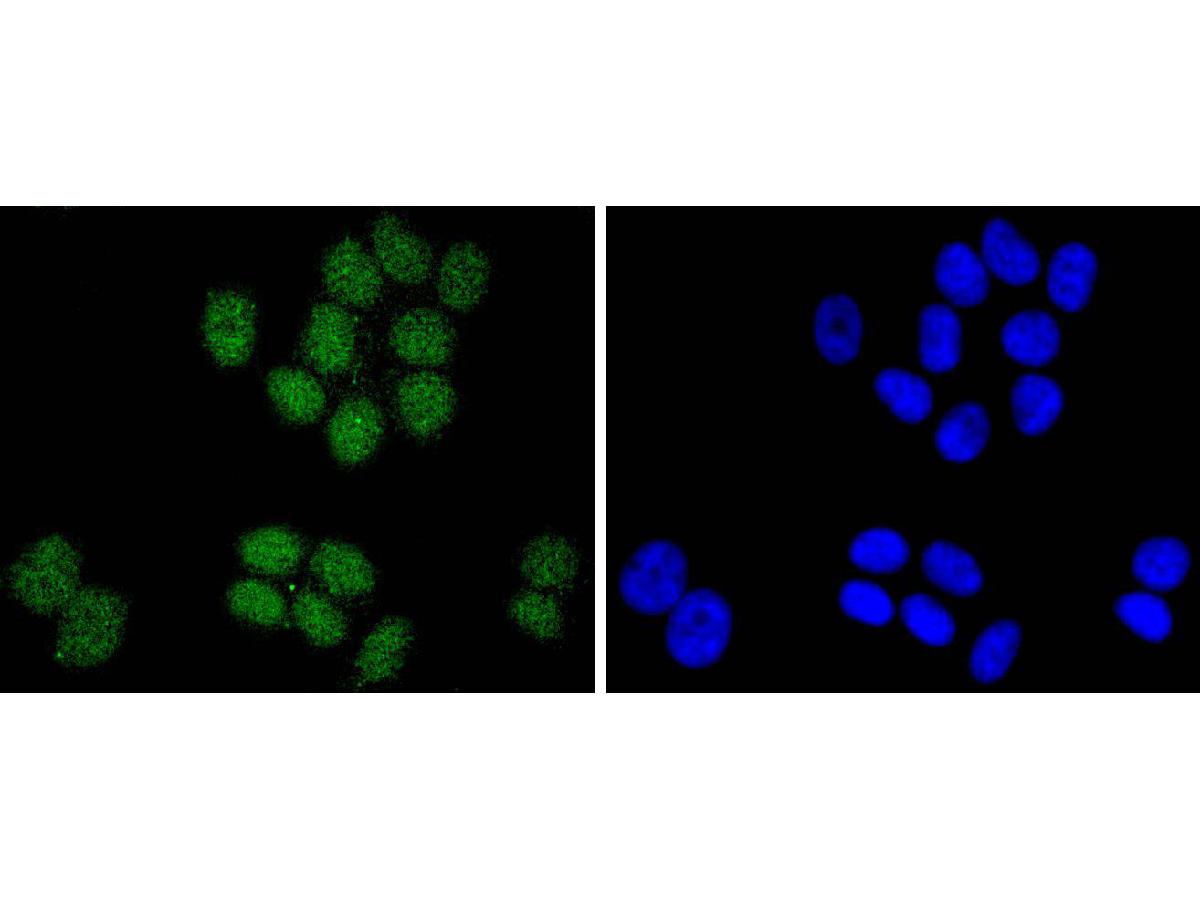 ICC staining SUZ12 in MCF-7 cells (green). The nuclear counter stain is DAPI (blue). Cells were fixed in paraformaldehyde, permeabilised with 0.25% Triton X100/PBS.