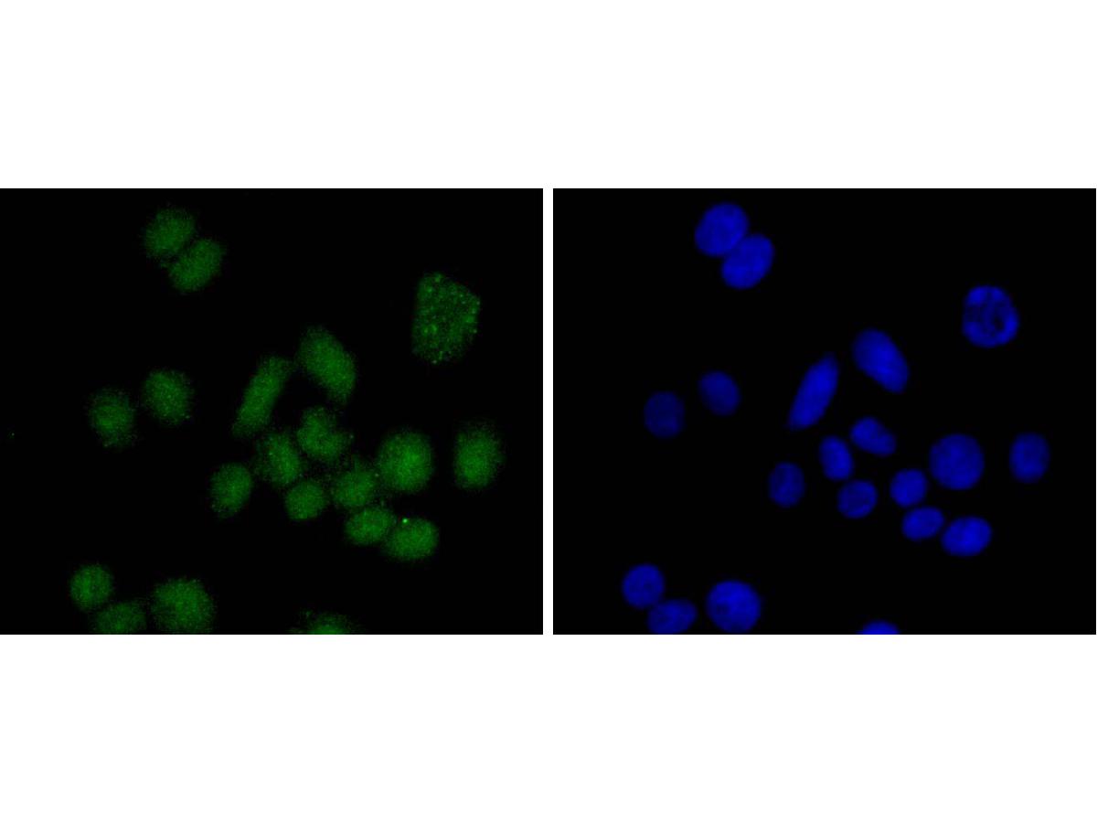 ICC staining SUZ12 in SW480 cells (green). The nuclear counter stain is DAPI (blue). Cells were fixed in paraformaldehyde, permeabilised with 0.25% Triton X100/PBS.