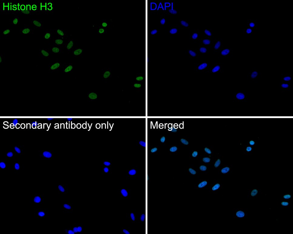 Immunocytochemistry analysis of Hela cells labeling Histone H3 with Rabbit anti-Histone H3 antibody (ET1701-64) at 1/100 dilution.<br />
<br />
Cells were fixed in 4% paraformaldehyde for 10 minutes at 37 ℃, permeabilized with 0.05% Triton X-100 in PBS for 20 minutes, and then blocked with 2% negative goat serum for 30 minutes at room temperature. Cells were then incubated with Rabbit anti-Histone H3 antibody (ET1701-64) at 1/100 dilution in 2% negative goat serum overnight at 4 ℃. Goat Anti-Rabbit IgG H&L (iFluor™ 488, HA1121) was used as the secondary antibody at 1/1,000 dilution. PBS instead of the primary antibody was used as the secondary antibody only control. Nuclear DNA was labelled in blue with DAPI.