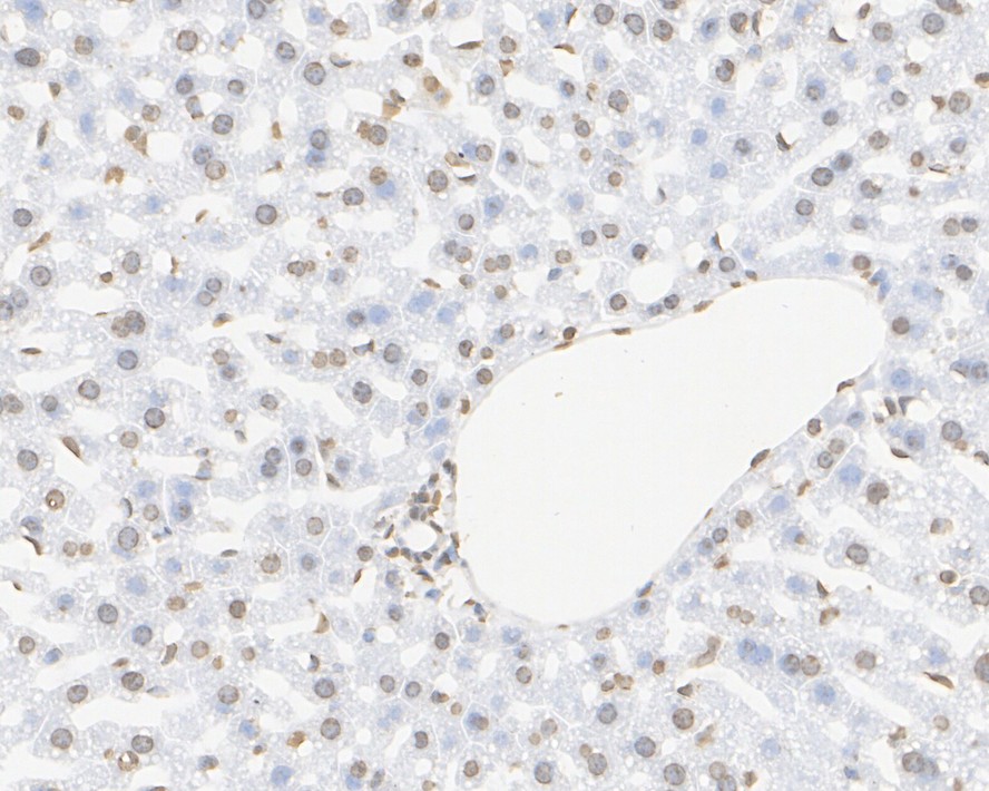 Immunohistochemical analysis of paraffin-embedded human liver tissue using anti-Histone H3 antibody. The section was pre-treated using heat mediated antigen retrieval with Tris-EDTA buffer (pH 9.0) for 20 minutes.The tissues were blocked in 1% BSA for 30 minutes at room temperature, washed with ddH2O and PBS, and then probed with the primary antibody (ET1701-64, 1/50) for 30 minutes at room temperature. The detection was performed using an HRP conjugated compact polymer system. DAB was used as the chromogen. Tissues were counterstained with hematoxylin and mounted with DPX.